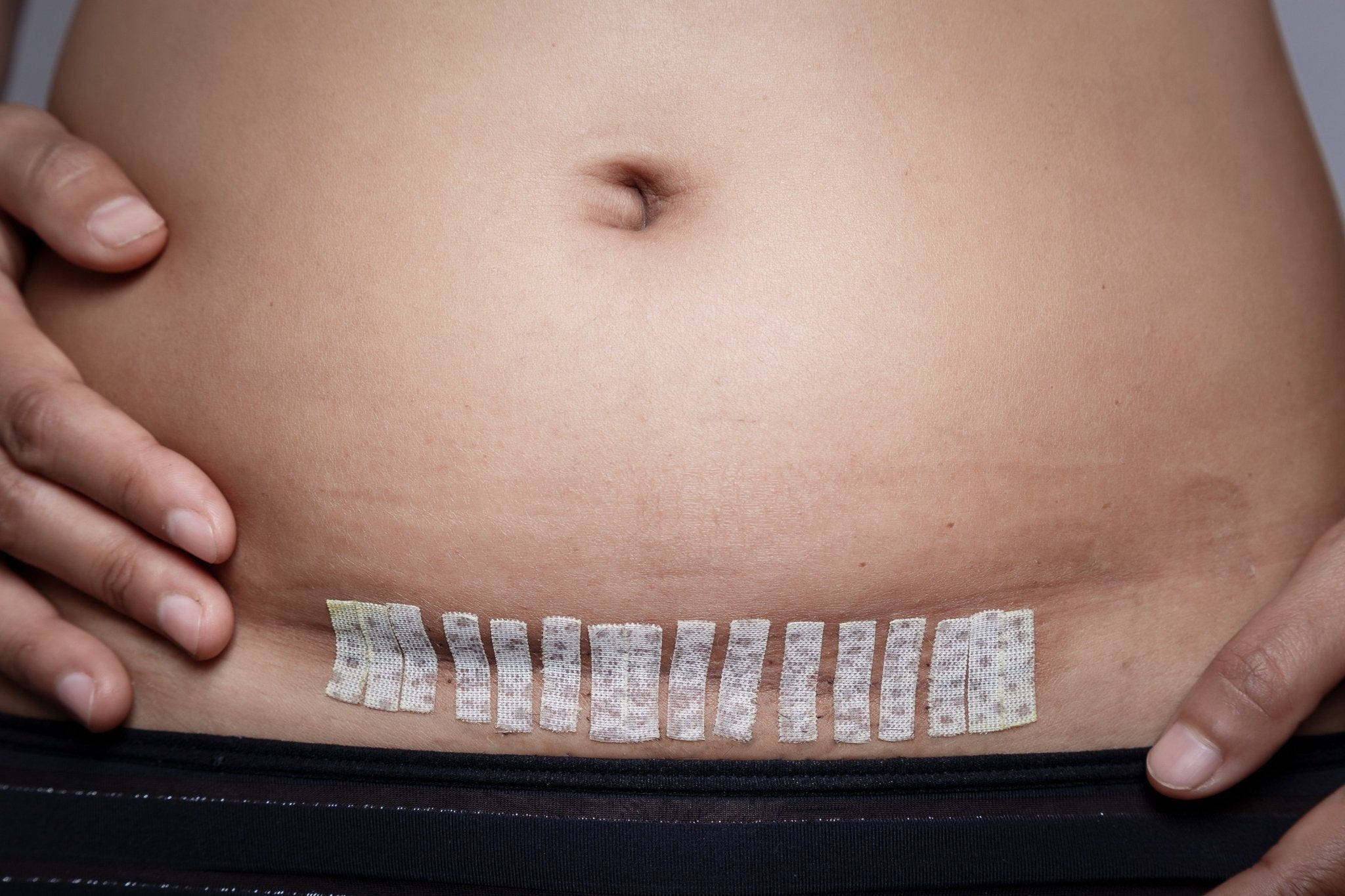 UK Women Postpartum C-Section After Birth Waist Trainer Belt